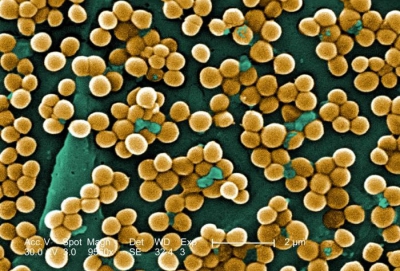 Where Does Staphylococcus Aureus Come From?