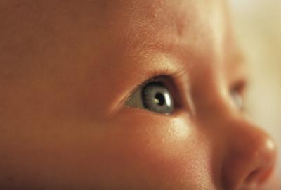 Ի՞նչ է անհասության ռետինոպաթիան. հնարավո՞ր է արդյոք կանխարգելել նորածնային կուրությունը