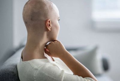 Մազերի կորուստը քիմիաթերապիայի ընթացքում: Ի՞նչ անել