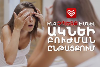 Ինչ չպետք է անել ակնեի բուժման ընթացքում