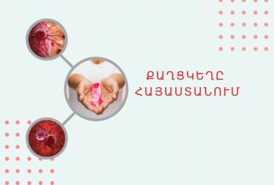 Քաղցկեղի դեմ պայքարի միջազգային օր. իրավիճակը Հայաստանում