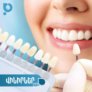 «Perfect Smile» стоматологическая клиника