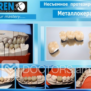 Կարեն Դենտ ատամնատեխնիկական լաբորատորիա
