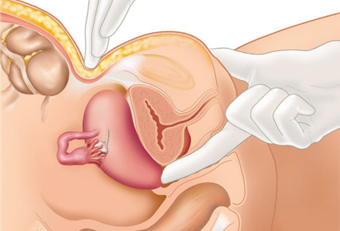 Գինեկոլոգիական հետազոտություն