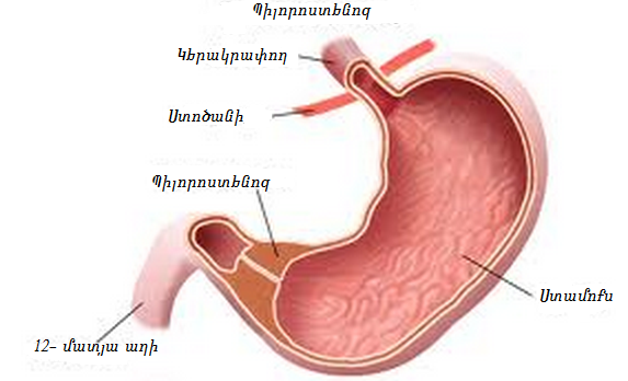 Պիլորոստենոզ