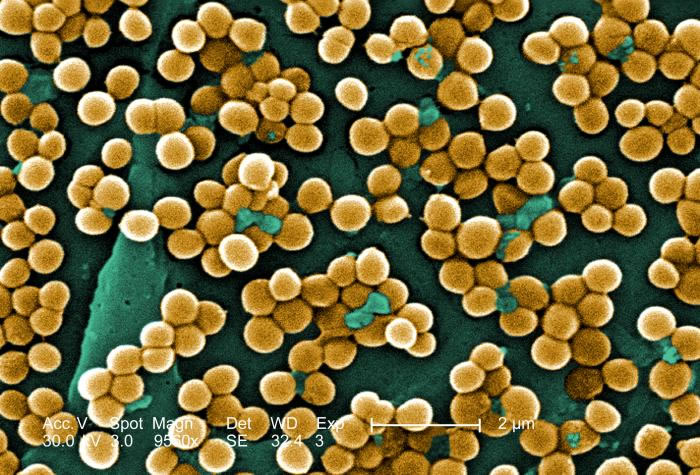 Ученые поняли, откуда пришел один из самых опасных патогенов в мире