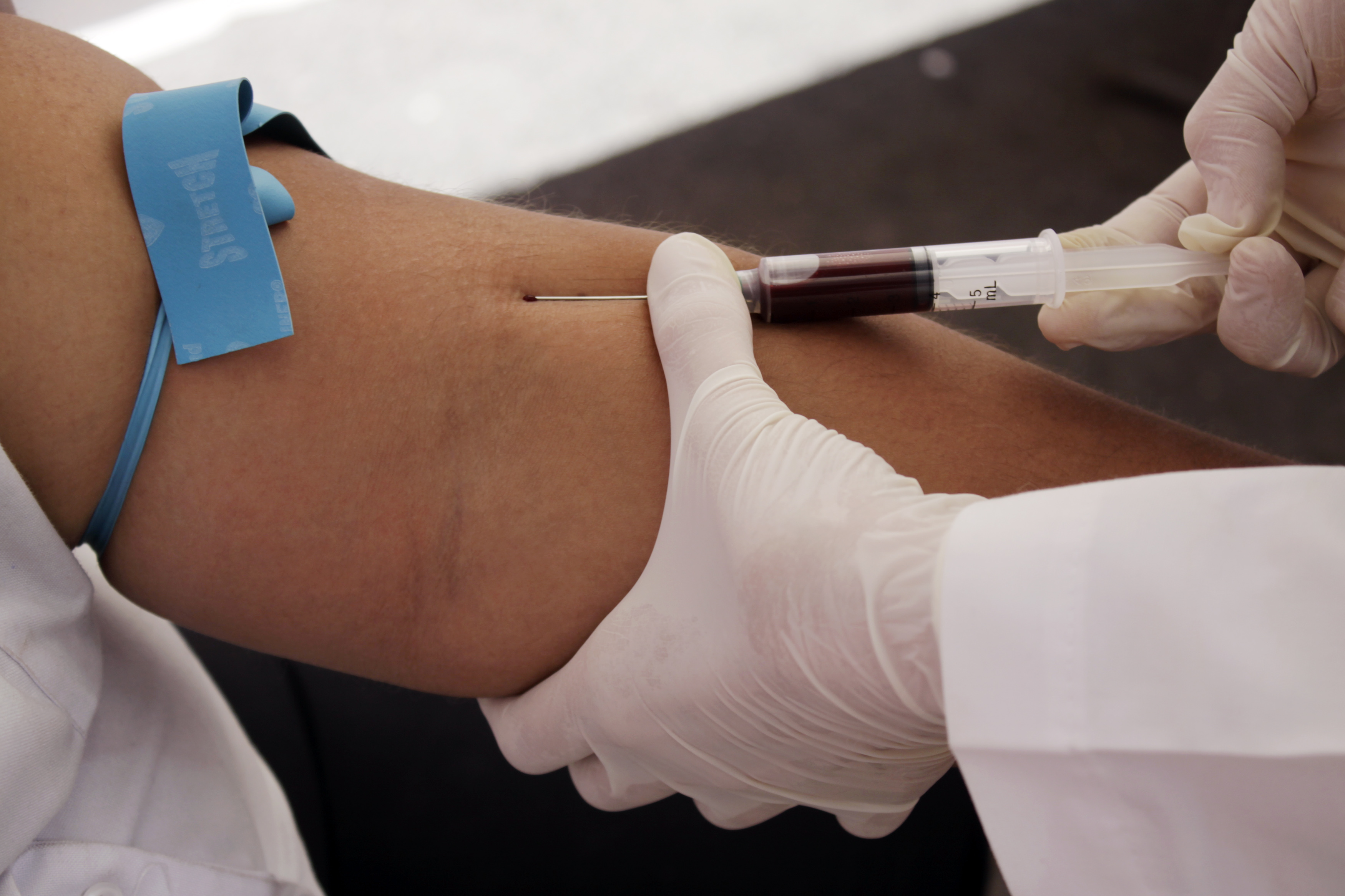 Արյան նոր թեստը հնարավորություն կտա հայտնաբերել դեպրեսիվ խանգարումները
