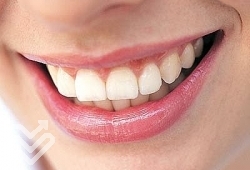Պարզ միջոցներ Ձեր ատամների առողջությունը պահպանելու համար