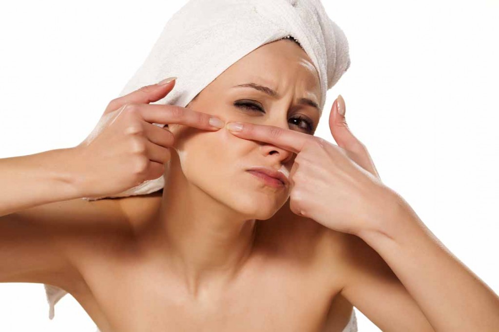 Top 8 Acne Treatment Mistakes
